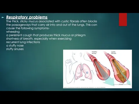 Respiratory problems The thick, sticky mucus associated with cystic fibrosis often