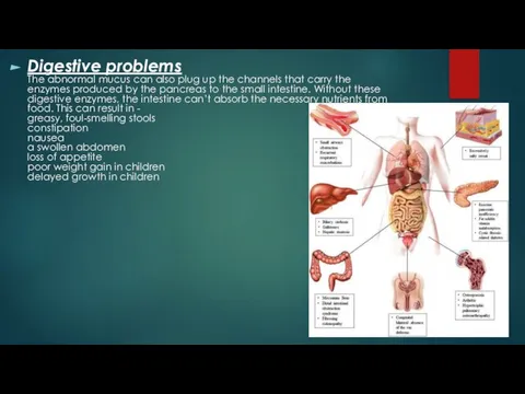 Digestive problems The abnormal mucus can also plug up the channels