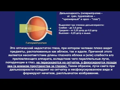 Дальнозоркость (гиперметропия – от греч. hypermetros – "чрезмерный" и opos –