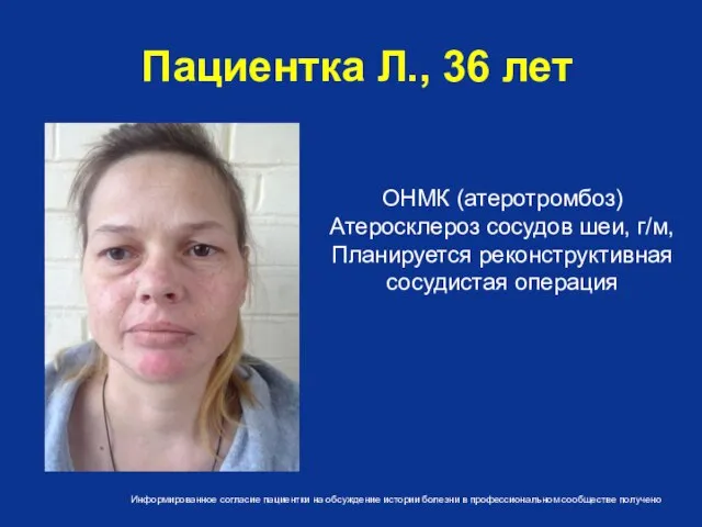 Пациентка Л., 36 лет ОНМК (атеротромбоз) Атеросклероз сосудов шеи, г/м, Планируется