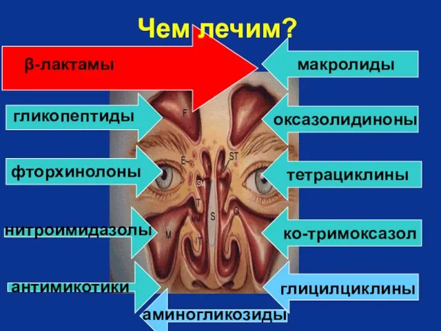 β-лактамы фторхинолоны нитроимидазолы гликопептиды оксазолидиноны макролиды тетрациклины ко-тримоксазол Чем лечим? глицилциклины антимикотики аминогликозиды