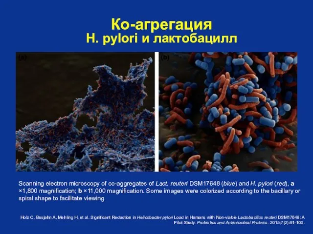 Scanning electron microscopy of co-aggregates of Lact. reuteri DSM17648 (blue) and