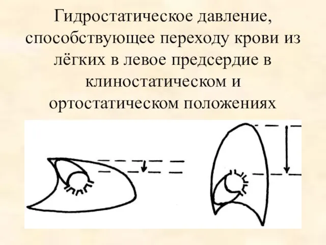 Гидростатическое давление, способствующее переходу крови из лёгких в левое предсердие в клиностатическом и ортостатическом положениях