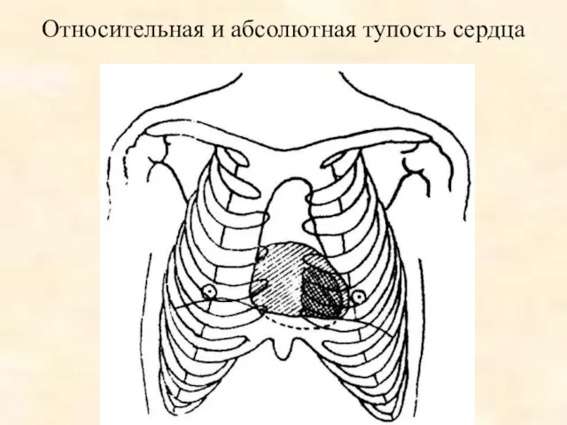 Относительная и абсолютная тупость сердца