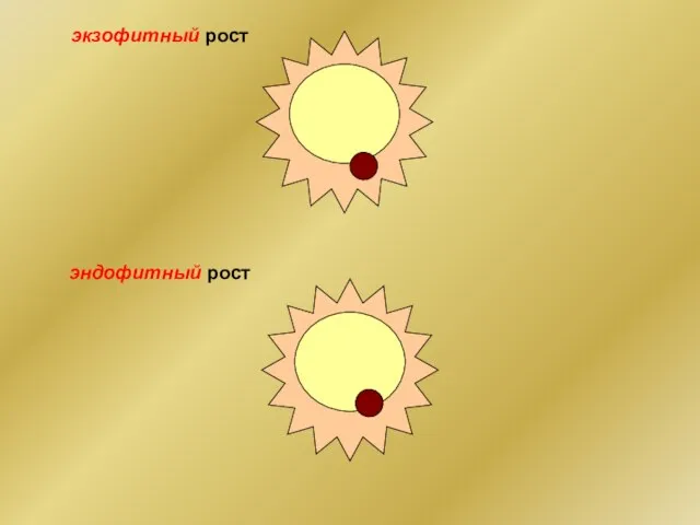 экзофитный рост эндофитный рост