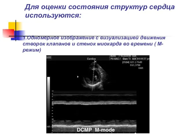 Для оценки состояния структур сердца используются: 1.Одномерное изображение с визуализацией движения
