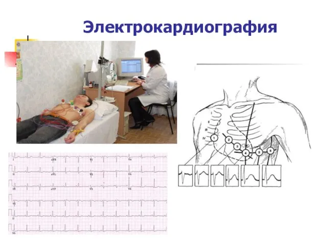 Электрокардиография