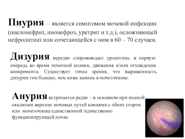 Пиурия – является симптомом мочевой инфекции (пиелонефрит, пионефроз, уретрит и т.д.),