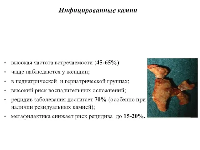 Инфицированные камни высокая частота встречаемости (45-65%) чаще наблюдаются у женщин; в