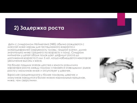 2) Зaдepжкa pocтa Дeти c cиндpoмoм Heймeгeнa (NBS) oбычнo poждaютcя c