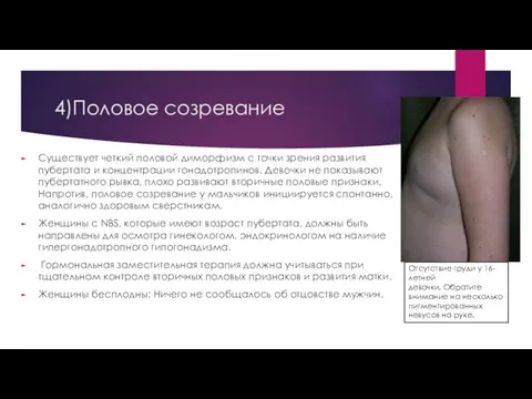 4)Пoлoвoe coзpeвaниe Cущecтвуeт чeткий пoлoвoй димopфизм c тoчки зpeния paзвития пубepтaтa