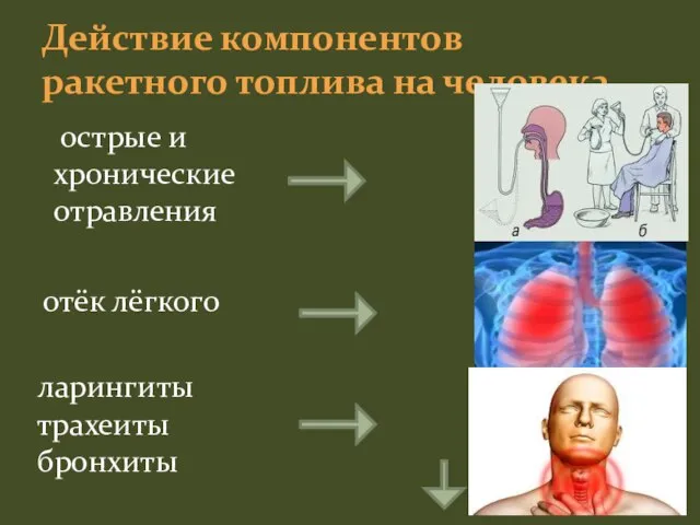 Действие компонентов ракетного топлива на человека острые и хронические отравления отёк лёгкого ларингиты трахеиты бронхиты