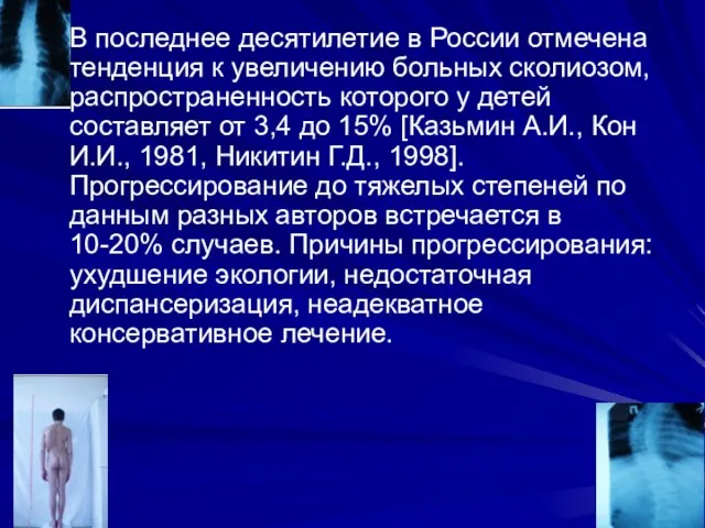 В последнее десятилетие в России отмечена тенденция к увеличению больных сколиозом,