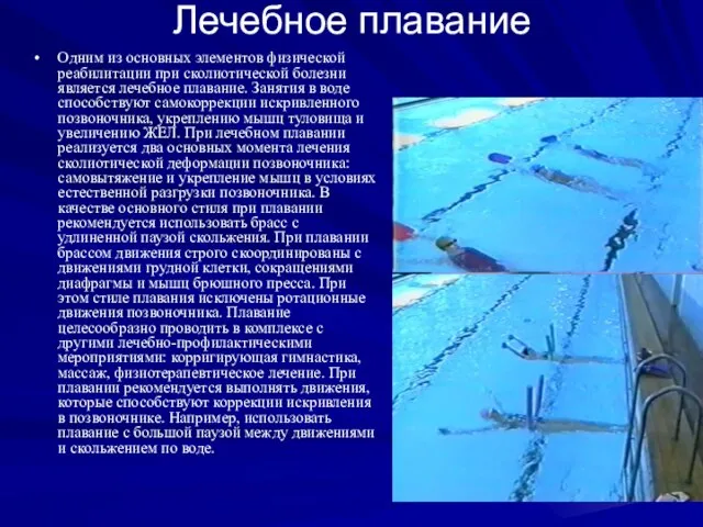 Лечебное плавание Одним из основных элементов физической реабилитации при сколиотической болезни