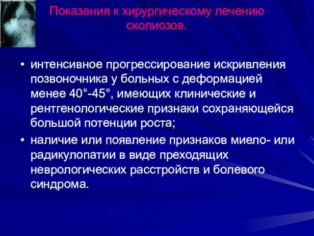 Показания к хирургическому лечению сколиозов. интенсивное прогрессирование искривления позвоночника у больных