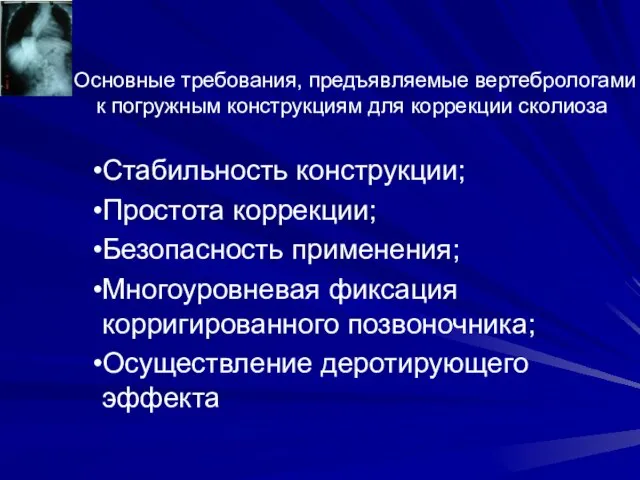 Основные требования, предъявляемые вертебрологами к погружным конструкциям для коррекции сколиоза Стабильность