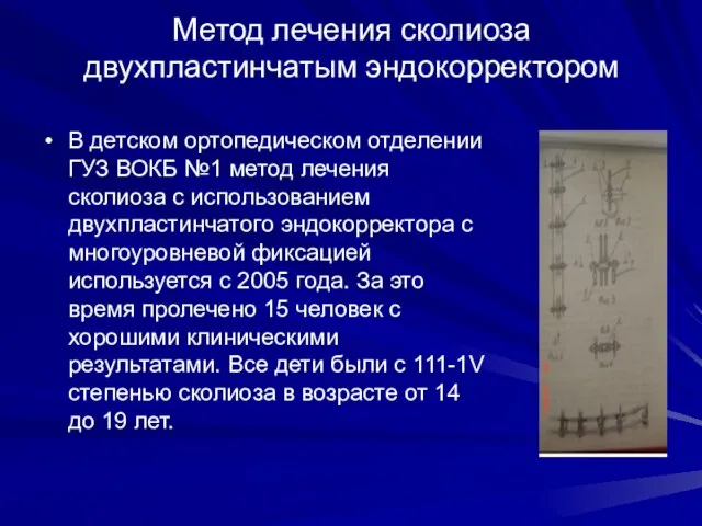 Метод лечения сколиоза двухпластинчатым эндокорректором В детском ортопедическом отделении ГУЗ ВОКБ