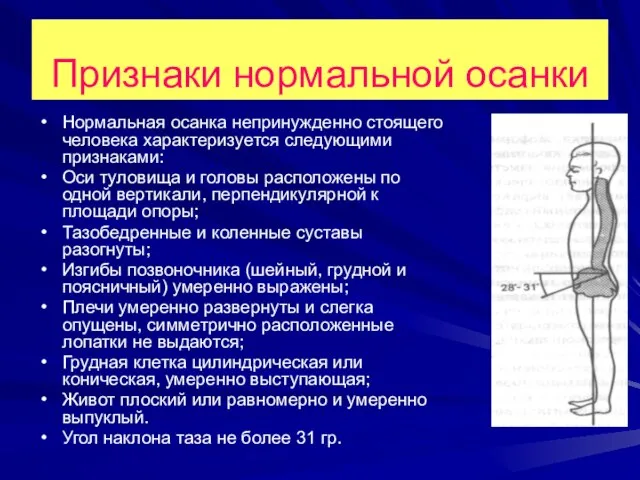 Признаки нормальной осанки Нормальная осанка непринужденно стоящего человека характеризуется следующими признаками: