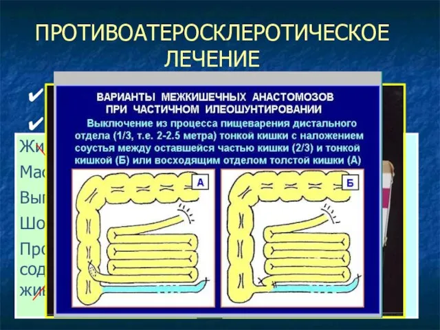 ПРОТИВОАТЕРОСКЛЕРОТИЧЕСКОЕ ЛЕЧЕНИЕ Диета Регулярные физические нагрузки Отказ от курения Постоянный прием