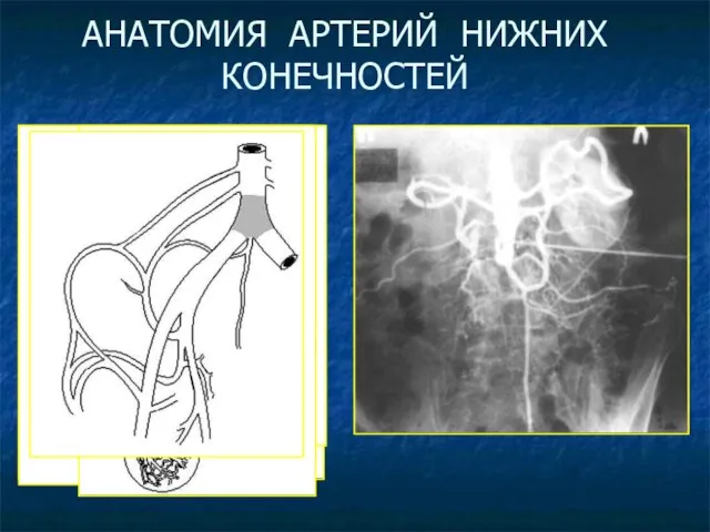 АНАТОМИЯ АРТЕРИЙ НИЖНИХ КОНЕЧНОСТЕЙ