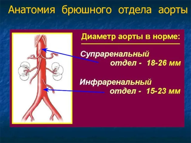 Анатомия брюшного отдела аорты