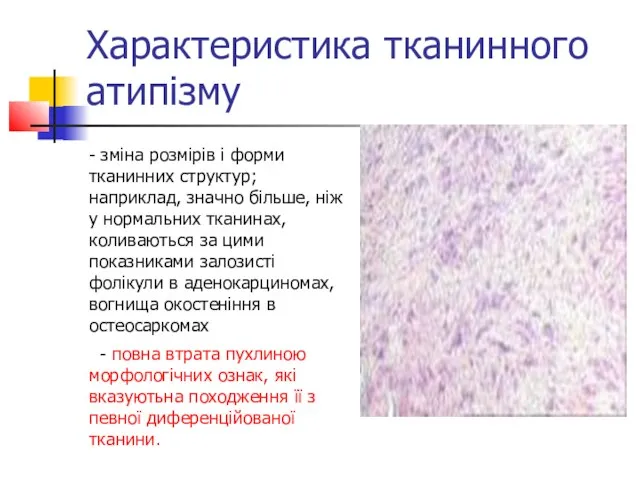 Характеристика тканинного атипізму - зміна розмірів і форми тканинних структур; наприклад,