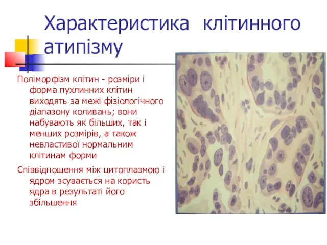 Характеристика клітинного атипізму Поліморфізм клітин - розміри і форма пухлинних клітин