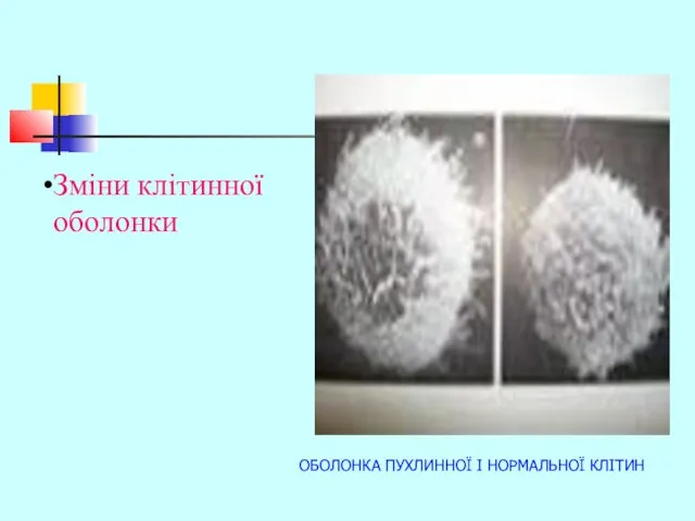 ОБОЛОНКА ПУХЛИННОЇ І НОРМАЛЬНОЇ КЛІТИН Зміни клітинної оболонки