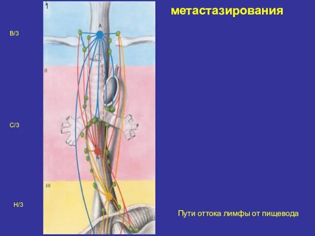 метастазирования Пути оттока лимфы от пищевода 1 В/3 С/3 Н/3