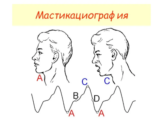 Мастикациография