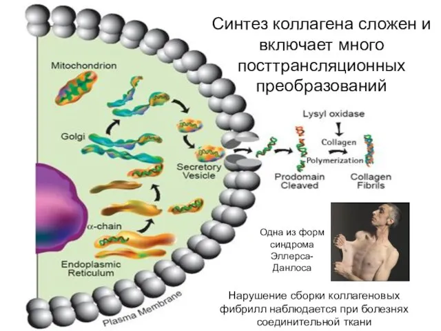 Синтез коллагена сложен и включает много посттрансляционных преобразований Нарушение сборки коллагеновых