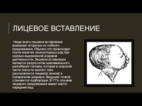 ЛИЦЕВОЕ ВСТАВЛЕНИЕ Чаще всего лицевое вставление возникает вторично из лобного предлежания.