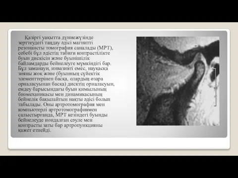 Қазіргі уақытта дүниежүзінде зерттеудегі таңдау әдісі магнитті резонансты томография саналады (МРТ),