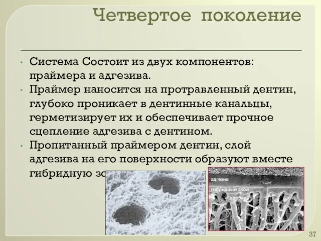 Четвертое поколение Система Состоит из двух компонентов: праймера и адгезива. Праймер