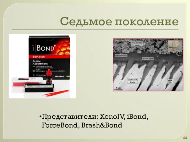 Седьмое поколение Представители: XenoIV, iBond, ForceBond, Brash&Bond