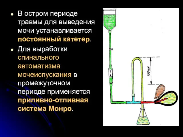 В остром периоде травмы для выведения мочи устанавливается постоянный катетер. Для