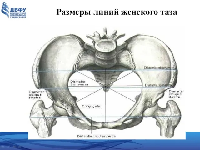 Размеры линий женского таза