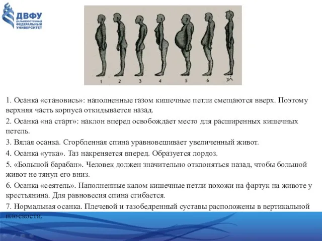 1. Осанка «становись»: наполненные газом кишечные петли смещаются вверх. Поэтому верхняя