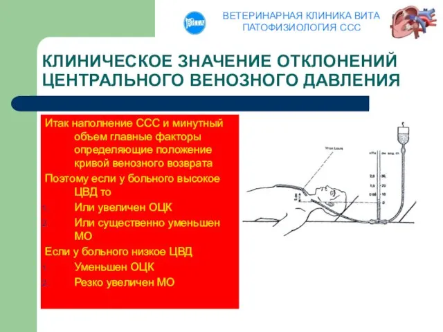 КЛИНИЧЕСКОЕ ЗНАЧЕНИЕ ОТКЛОНЕНИЙ ЦЕНТРАЛЬНОГО ВЕНОЗНОГО ДАВЛЕНИЯ Итак наполнение ССС и минутный