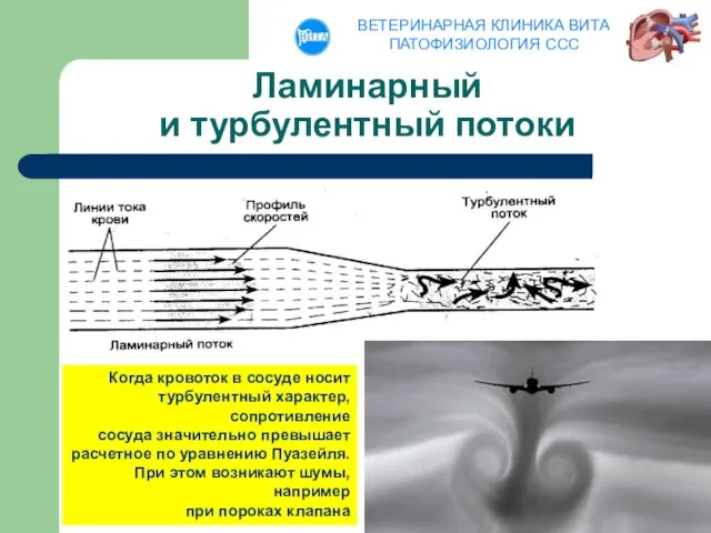 Ламинарный и турбулентный потоки Когда кровоток в сосуде носит турбулентный характер,