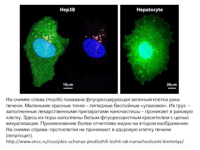 На снимке слева (Hep3B) показана флуоресцирующая зеленым клетка рака печени. Маленькие