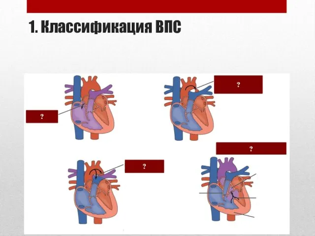 1. Классификация ВПС