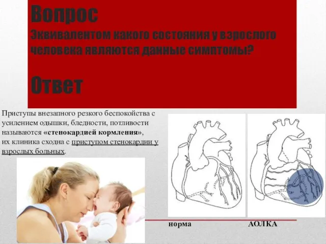 Вопрос Эквивалентом какого состояния у взрослого человека являются данные симптомы? Ответ