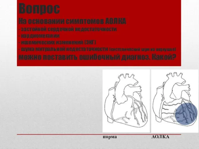 Вопрос На основании симптомов АОЛКА - застойной сердечной недостаточности - кардиомегалии