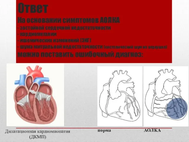 Ответ На основании симптомов АОЛКА - застойной сердечной недостаточности - кардиомегалии