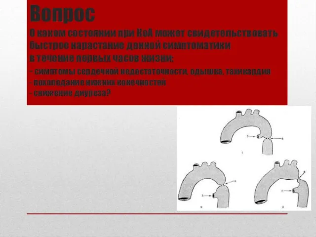 Вопрос О каком состоянии при КоА может свидетельствовать быстрое нарастание данной