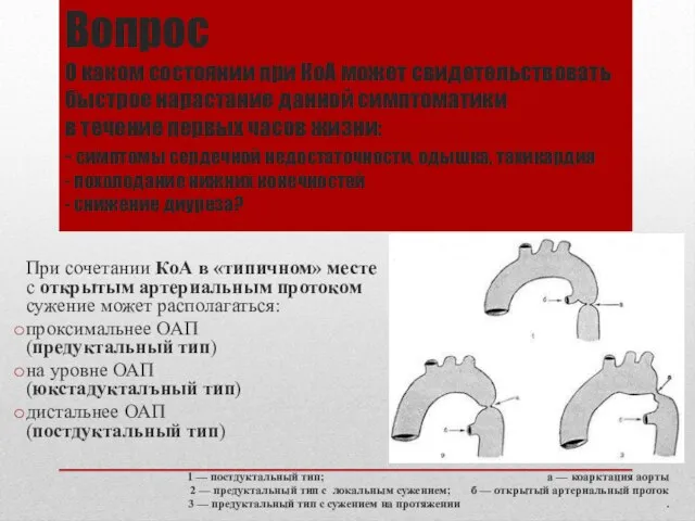 Вопрос О каком состоянии при КоА может свидетельствовать быстрое нарастание данной