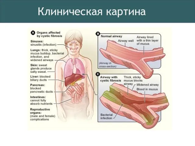 Клиническая картина