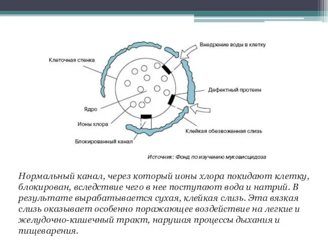 Нормальный канал, через который ионы хлора покидают клетку, блокирован, вследствие чего