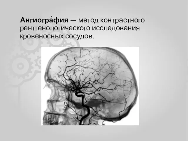 Ангиогра́фия — метод контрастного рентгенологического исследования кровеносных сосудов.